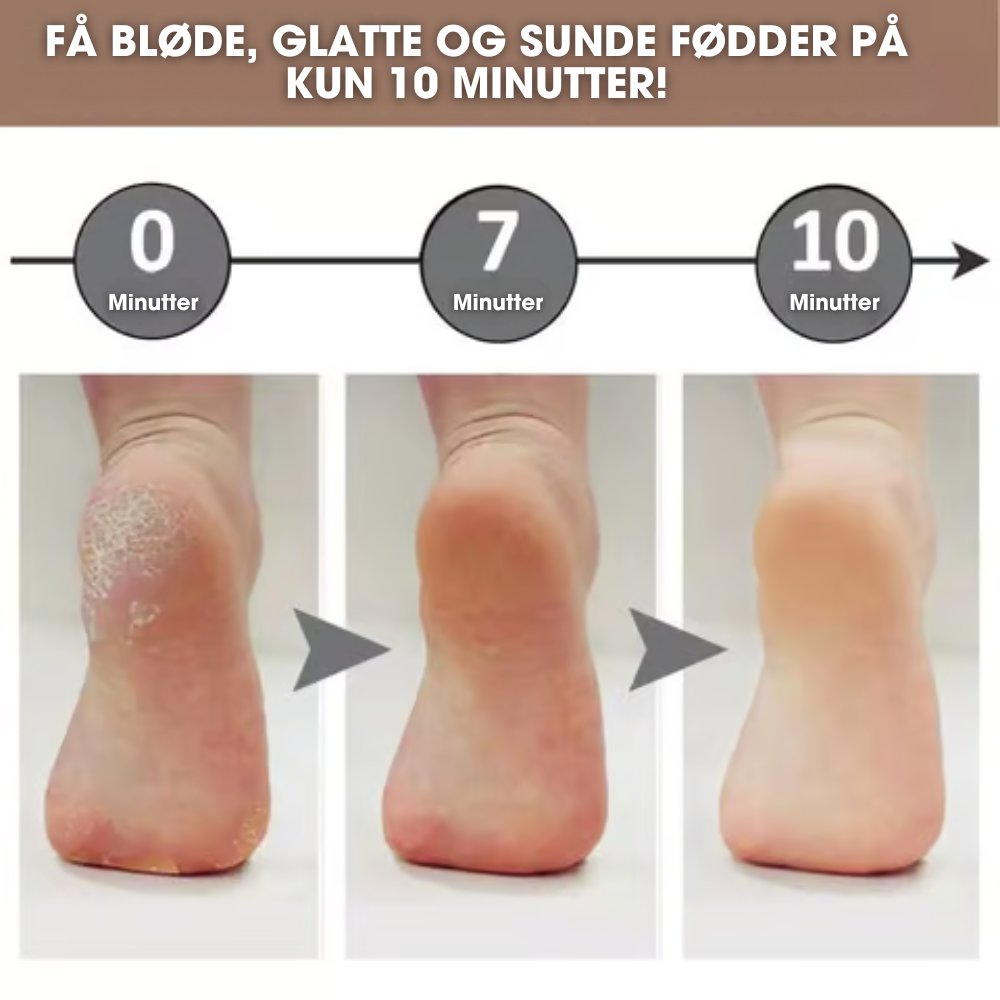 Elora - Elektrisk eeltfjerner