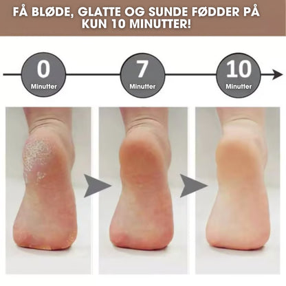 Elora - Elektrisk eeltfjerner